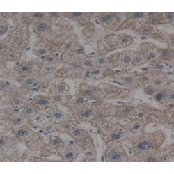 Osteopetrosis Associated Transmembrane Protein 1 (OSTM1) Antibody