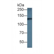 Western blot analysis of Human HeLa cell lysate, using Mouse NIN Antibody (1 µg/ml) and HRP-conjugated Goat Anti-Rabbit antibody (<a href="https://www.abbexa.com/index.php?route=product/search&amp;search=abx400043" target="_blank">abx400043</a>, 0.2 µg/ml).