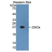 Western blot analysis of the recombinant protein.