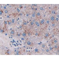 Hydroxyacyl Coenzyme A Dehydrogenase (HADH) Antibody