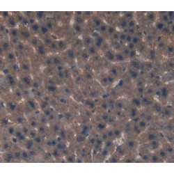 Eukaryotic Translation Initiation Factor 2D (EIF2D) Antibody