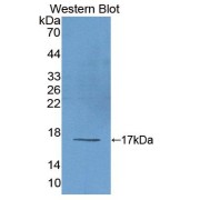 Western blot analysis of the recombinant protein.