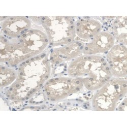 V-Erb A Erythroblastic Leukemia Viral Oncogene Homolog 4 (ErbB4) Antibody