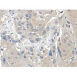 V-Erb A Erythroblastic Leukemia Viral Oncogene Homolog 4 (ErbB4) Antibody