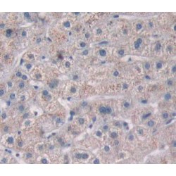 Protein Tyrosine Phosphatase Type IVA 2 (PTP4A2) Antibody