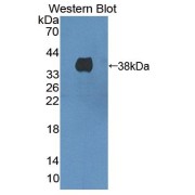 Western blot analysis of the recombinant protein.