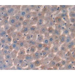 3-Hydroxymethyl-3-Methylglutaryl Coenzyme A Lyase (HMGCL) Antibody