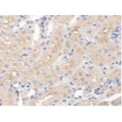 Serine Palmitoyltransferase, Long Chain Base Subunit 1 (SPTLC1) Antibody