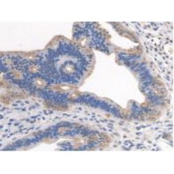 Serine Palmitoyltransferase, Long Chain Base Subunit 1 (SPTLC1) Antibody