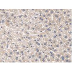 Serine Palmitoyltransferase, Long Chain Base Subunit 1 (SPTLC1) Antibody