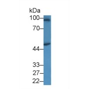 Western blot analysis of Human Jurkat cell lysate, using Human SPAG1 Antibody (1 µg/ml) and HRP-conjugated Goat Anti-Rabbit antibody (<a href="https://www.abbexa.com/index.php?route=product/search&amp;search=abx400043" target="_blank">abx400043</a>, 0.2 µg/ml).