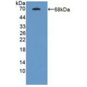Western blot analysis of recombinant Human MAN1A1 (with N-terminal His and GST tags).