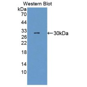 Western blot analysis of the recombinant protein.