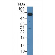 Western blot analysis of Human IgA1,1ul cell lysate, using Human IgA1 Antibody (1 µg/ml) and HRP-conjugated Goat Anti-Rabbit antibody (<a href="https://www.abbexa.com/index.php?route=product/search&amp;search=abx400043" target="_blank">abx400043</a>, 0.2 µg/ml).