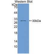 Western blot analysis of the recombinant protein.