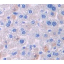 Inhibitor of Nuclear Factor Kappa-B Kinase Subunit Beta / IKKB (IKBKB) Antibody