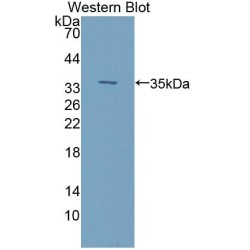 Integrin-Linked Protein Kinase (ILK) Antibody