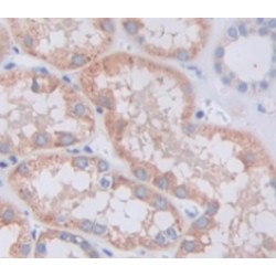 Talin 2 (TLN2) Antibody