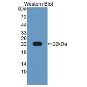 Western blot analysis of the recombinant protein.