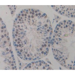 Cyclin Dependent Kinase Inhibitor 2D (CDKN2D) Antibody