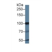 Western blot analysis of Human Jurkat cell lysate, using Human INPP4A Antibody (1 µg/ml) and HRP-conjugated Goat Anti-Rabbit antibody (<a href="https://www.abbexa.com/index.php?route=product/search&amp;search=abx400043" target="_blank">abx400043</a>, 0.2 µg/ml).