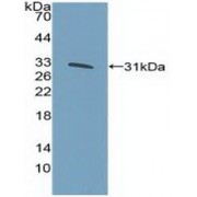 Western blot analysis of recombinant Human KLF5.