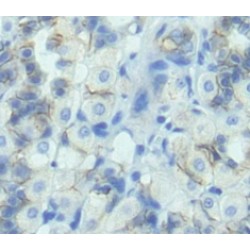 Lactase (LCT) Antibody