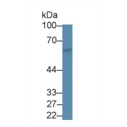 Western blot analysis of Mouse Cerebrum lysate, using Mouse SPTLC2 Antibody (1 µg/ml) and HRP-conjugated Goat Anti-Rabbit antibody (<a href="https://www.abbexa.com/index.php?route=product/search&amp;search=abx400043" target="_blank">abx400043</a>, 0.2 µg/ml).