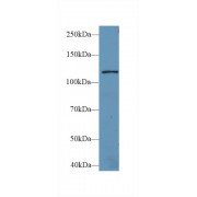 Western blot analysis of Mouse Liver lysate, using Human LARS Antibody (2 µg/ml) and HRP-conjugated Goat Anti-Rabbit antibody (<a href="https://www.abbexa.com/index.php?route=product/search&amp;search=abx400043" target="_blank">abx400043</a>, 0.2 µg/ml).