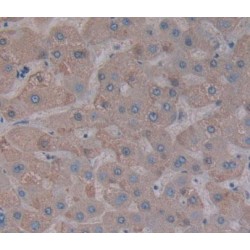 Protein Tyrosine Phosphatase F Interacting Protein 1 (PPFIA1) Antibody