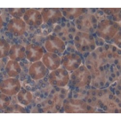 Aminoadipate Semialdehyde Synthase (AASS) Antibody