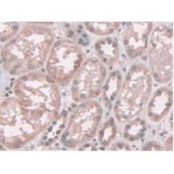 Aminoadipate Semialdehyde Synthase (AASS) Antibody