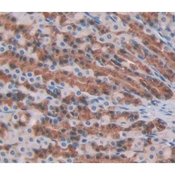 Protein Tyrosine Phosphatase, Non Receptor Type 22 (PTPN22) Antibody