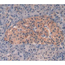 Mitogen-Activated Protein Kinase Kinase Kinase 5 (MAP3K5) Antibody