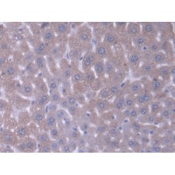 Acyl Coenzyme A Dehydrogenase, C4-To-C12 Straight Chain (ACADM) Antibody