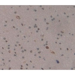 Myocyte Specific Enhancer Factor 2A (MEF2A) Antibody