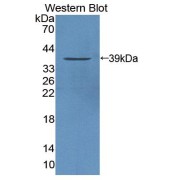 Western blot analysis of the recombinant protein.