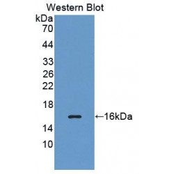 Methionyl tRNA Synthetase (MARS) Antibody