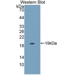 Sialomucin Core Protein 24 (CD164) Antibody