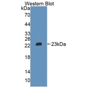 abx131323