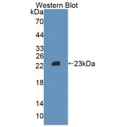 Western blot analysis of the recombinant protein.