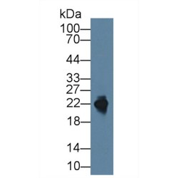 Cluster of Differentiation 99 (CD99) Antibody