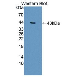 Cluster of Differentiation 99 (CD99) Antibody