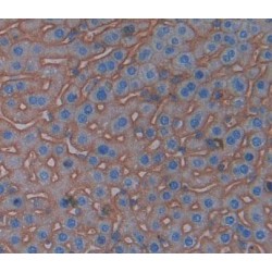 Cluster of Differentiation 99 (CD99) Antibody