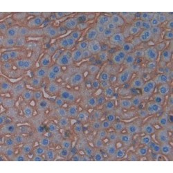 Cluster of Differentiation 99 (CD99) Antibody