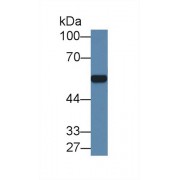 Western blot analysis of Mouse Kidney lysate, using Human ARSA Antibody (1 µg/ml) and HRP-conjugated Goat Anti-Rabbit antibody (<a href="https://www.abbexa.com/index.php?route=product/search&amp;search=abx400043" target="_blank">abx400043</a>, 0.2 µg/ml).