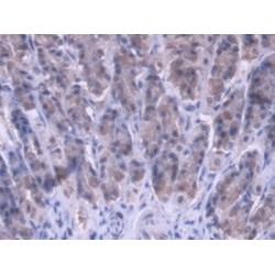 Mitochondrial Ribosomal Protein L1 (MRPL1) Antibody