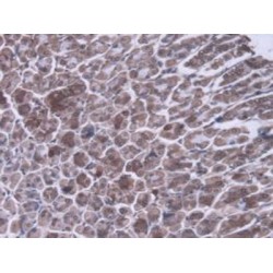Mitochondrial Ribosomal Protein L1 (MRPL1) Antibody