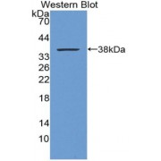Western blot analysis of recombinant Rat MT1.