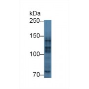 Western blot analysis of Human A549 cell lysate, using Mouse MYT1 Antibody (3 µg/ml) and HRP-conjugated Goat Anti-Rabbit antibody (<a href="https://www.abbexa.com/index.php?route=product/search&amp;search=abx400043" target="_blank">abx400043</a>, 0.2 µg/ml).